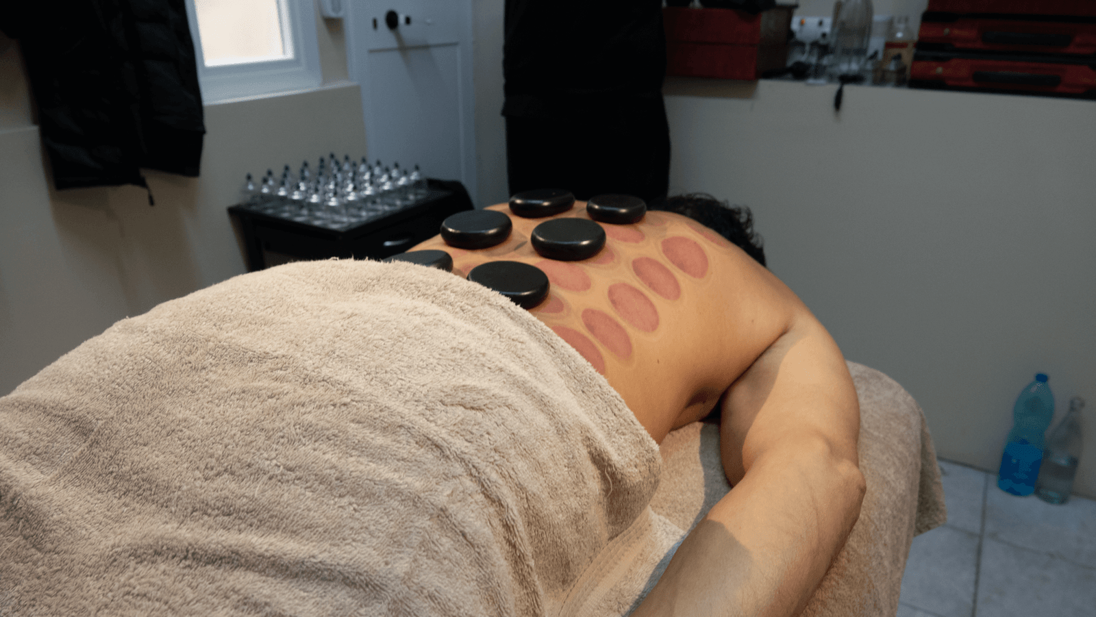 Light Summer Cupping