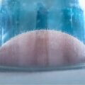 Cupping Therapy – Harnessing Ancient Techniques for Modern Health