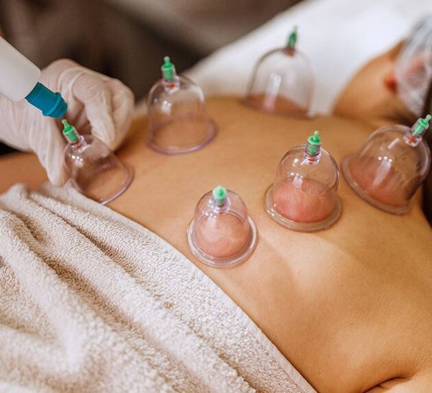 Light Summer Cupping  (Back) (L)